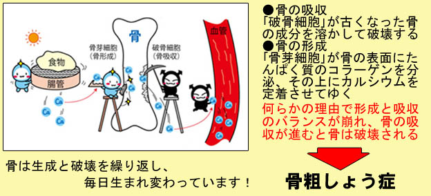 骨の吸収と破壊